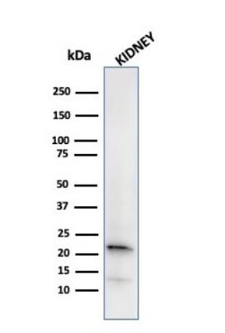 Ferritin Light Chain Antibody (FTL/2338R) - Azide and BSA Free, Novus Biologicals 100 &mu;g | Buy Online | Novus Biologicals | Fisher Scientific